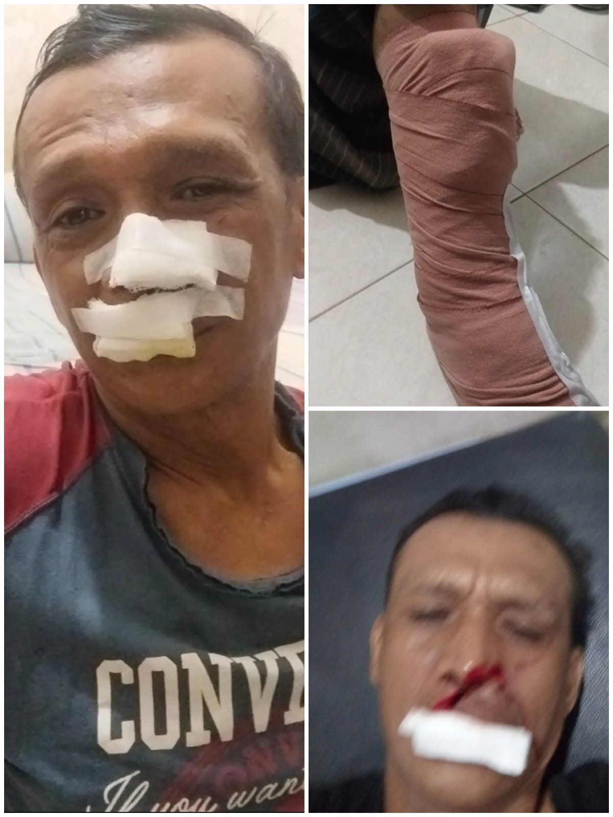 ‎Keluarga Korban Pembacokan di Medan Perjuangan Minta Polisi Segera Tangkap Pelaku